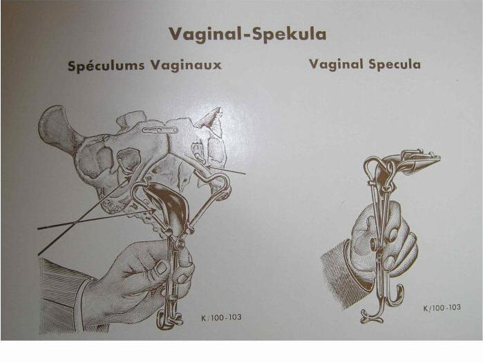 storia dello speculum vaginale,history of Vaginal Specula, histoire du